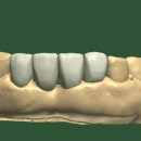 뉴치과기공소 이미지