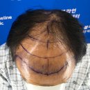 노블라인의원 이미지