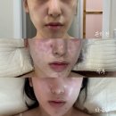 창원기계공구상가 | 창원 리프팅 찾다가 발견한 울트라플라 | 쉼스파에스테틱 후기