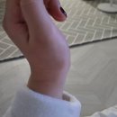에이스병원 | 손목결절종 시술후기(안산에이스병원/주차)
