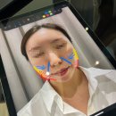 바이슈의원 | 바이슈의원 수면마취 써마지 FLX 600샷 내돈내산 시술후기 ( 붓기, 통증, 가격 )