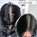 청량리30 | [뉴데이] 청량리숱채움 / 청량리 smp / 30대 여자 가마 숱채움 후기