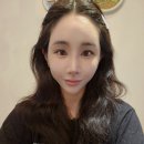 산소의원 | [신사/프레쉬홍닥터의원 후기] 얼굴 줄기세포 주사 + 고압산소 치료 솔직 전후 변화🩵✨ (1주차)