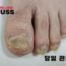 레푸스 사상점 이미지