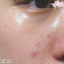 수아영