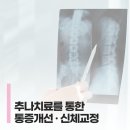 광교더바른한의원 | 광교추나요법 바른자세의 시작