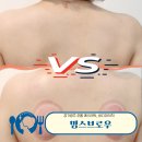 경기광주 초월 마사지 에스테틱 밍스브로우에서 등관리 받은 후기