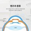 카이안과의원 | ㅋㅇ안과 렌즈삽입술 직원 찐 후기