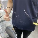 참피부미용
