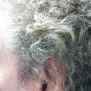 이상연보청기 이미지