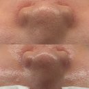 주식회사 스킨앤플러스 | 신중동에스테틱 | 코코스킨앤바디 | 피부관리 솔직후기 | 응급진정관리 |부천신부관리