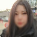 29170-5-B-01 | B 01. 대구 성형외과 절개쌍수+뒤(밑)트임 내돈내산 상세 찐 후기