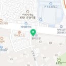 [응암동안과] 한세성모안과 백내장 수술 후기(서울 ○○○님)