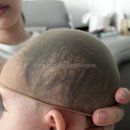 대호의료기 이미지