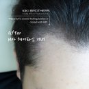 압구정동헤어라인