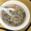 수화약국 | 편도절제술 코블레이터 총정리 리얼후기(통증,식단,꿀팁포함)