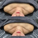 한울에스테틱_전주 에코시티 드레스라인관리 후기