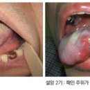 동인천치과 네이버블로그