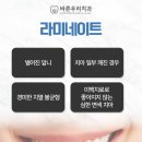 L&B치과의원 | 대구칠곡치과 라미네이트 얼마나 사용할 수 있나요?