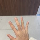 방아쇠수지인 줄 알았는데 윤활낭염이라니. 병원 바꾸고 나았어요