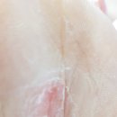 수유우태하피부과 | 우태하 한승경 피부과 강북본원 후기