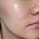 페스트케어 | 민감한피부 붉은기 진정케어 아토 패스트 카밍 세럼 사용후기