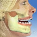 턱관절 기능장애(TMJ)란 무엇인가?｜통증의 원인을 제대로 이해하기 이미지