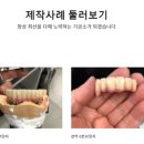 마루치과기공소 네이버블로그