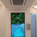 연세강연웅성형외과의원 | 서면성형외과 이중턱 근육묶기 한 후기 가져왔어요