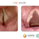 쉼 이미지
