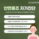 달아오름 이미지