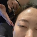 용산구 시민건강관리센터 | 용산탈모관리 시원한 탈모센터 후기 닥터모락 용산점