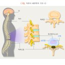 메디원코리아 | 퇴행성디스크 치료기 (x-ray, MRI, 신경차단술)