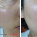 피스티오 이미지