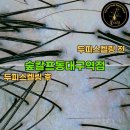 대구 동대구 두피관리 꼼꼼히 해주는 &#39;숲칼프 동대구역점&#39; 에서 두피 스케일링 받고 온 후기🌿