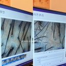 모앤영 당산점 | 20대여성 영등포탈모 트러블 모앤영영등포당산점 솔직후기