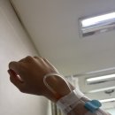 진해산소, 일사가스 | 담낭 절제 수술 (2) 입원 및 수술