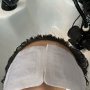 까망채움스칼프) 두피순환관리케어 후기 부산두피클리닉 추천