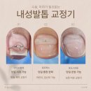 발톱을 뽑지 않고 치료하는 방법? 하안동 풋클리닉에서 확인하세요.