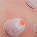 구인당한의원 이미지