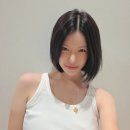 귀족 | 귀족수술 2개월 후기 | 웃을 때 얼굴 변화