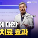 만성피로증후군 환자에게 비타민 C 치료를 했더니 생긴 변화 이미지