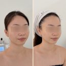 뮤 - 김해시 함박로101번길 22 | 대전 신부관리 아로뮤에스테틱 후기
