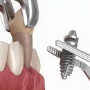 수플러스+치과의원 이미지