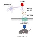 ■ 근육 긴장 이상증. 근근막 통증 증후군 치료제 개발 이미지