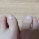 힐링네일&힐링푸스