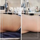 미아동 테라피 미아체형관리 비만체형 복부관리 통증 가성비테라피 맛집[권스킨앤바디]