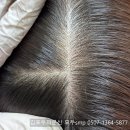 머리카락 - 광산구 | 김포두피문신 얇은머리카락 두피비침 해결후기