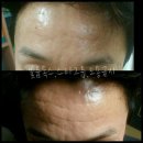 볼륨톡스 이미지