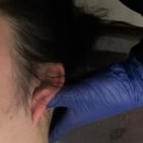 인덕원역 3번출구 차도 | 범계역 인덕원 얼굴비대칭관리 플로라스킨케어 두골비 관리